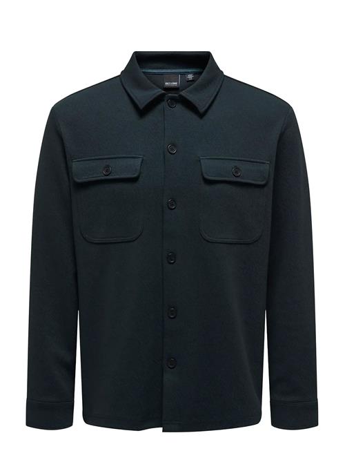 ONLY & SONS | Onsnewkodyl Overshirt Sweat Noos | L