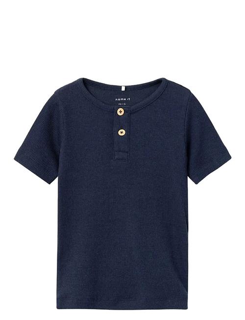 name it | Nmmkab Ss Top Noos | 80