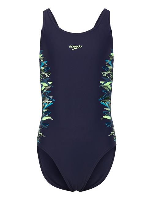Speedo | Placement Muscleback One Piece | 140