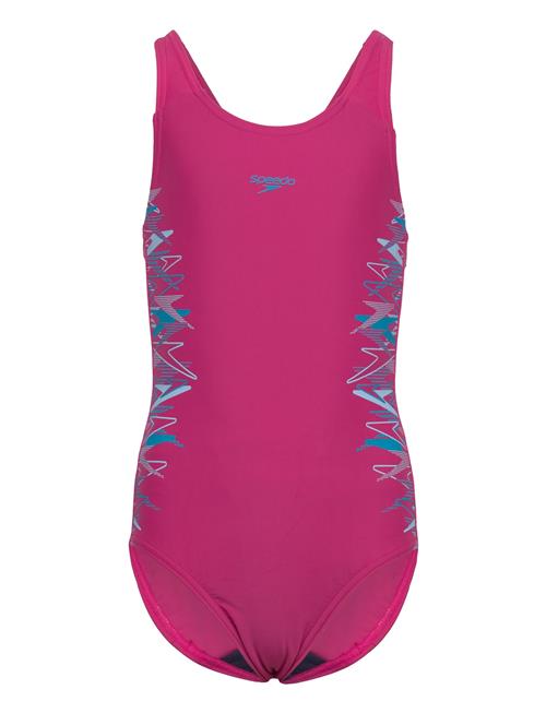 Speedo | Placement Muscleback One Piece | 152