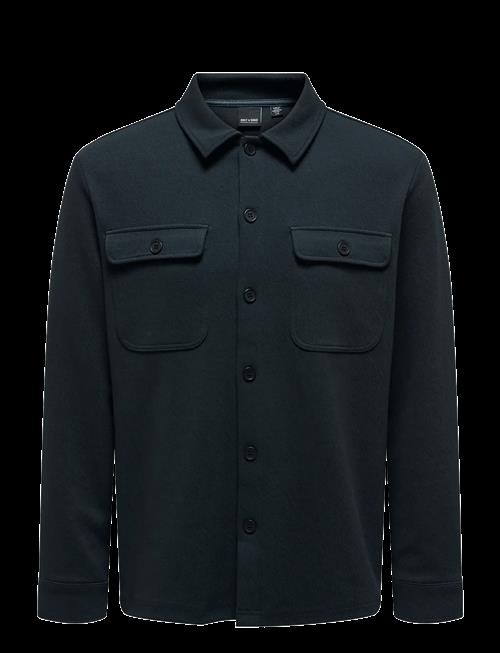 ONLY & SONS | Onsnewkodyl Overshirt Sweat Noos | XXL