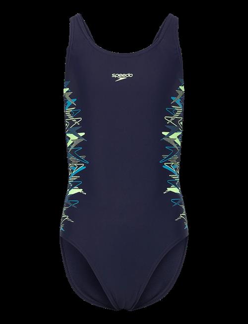Speedo | Placement Muscleback One Piece | 116