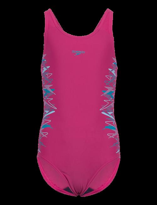 Speedo | Placement Muscleback One Piece | 176