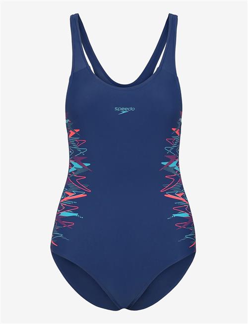 Speedo | Placement Muscleback 1Pc | 116